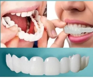 freshRemovable Temporary Teeth Braces Veneers Whitening False Dentures Perfect Fit Smile Cover CK848-fro
freshRemovable Temporary Teeth Braces Veneers Whitening False Dentures Perfect Fit Smile Cover CK848-fro