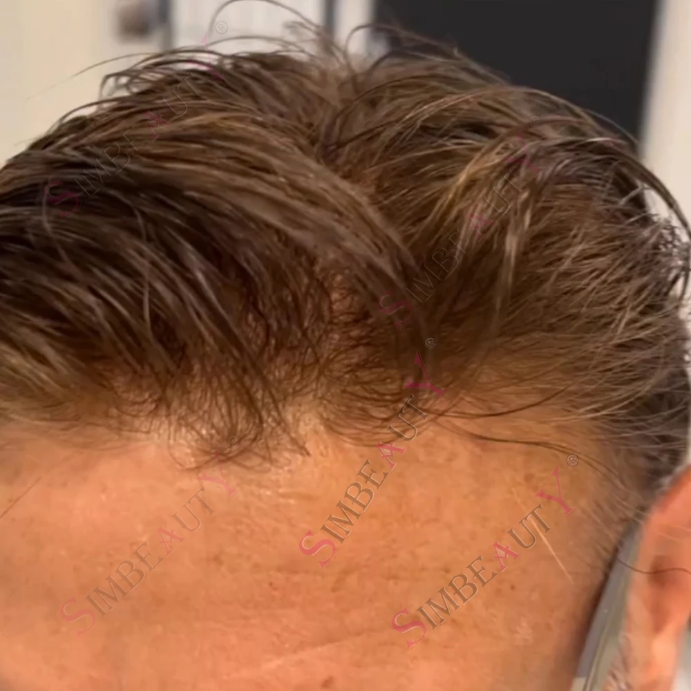 80~90% Density Natural Hairline 0.02mm Super Thin Skin Brown Invisible Vloop Men Toupee Grey Human Hair Capillar Prosthesis Syst
80~90% Density Natural Hairline 0.02mm Super Thin Skin Brown Invisible Vloop Men Toupee Grey Human Hair Capillar Prosthesis Syst