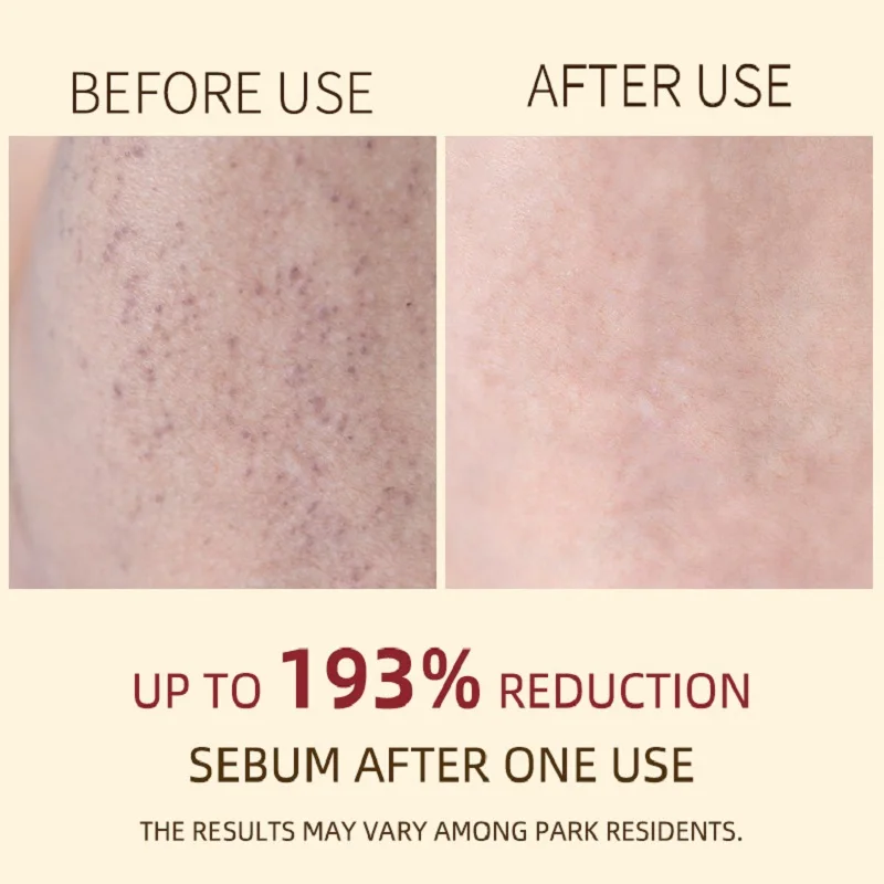 Korean White And Black Rice Exfoliating Serum Facial Moisturizing Soften Blackhead Removal Hydrating Pore Shrinking Skin Care
Korean White And Black Rice Exfoliating Serum Facial Moisturizing Soften Blackhead Removal Hydrating Pore Shrinking Skin Care