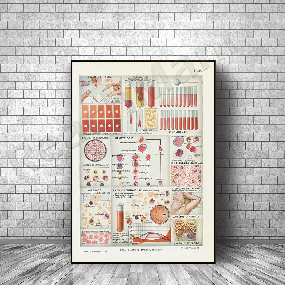 Blood test print from 1952. French vintage medical print. Hematology medical decoration. Doctor office medical gift. Anatomy Art
Blood test print from 1952. French vintage medical print. Hematology medical decoration. Doctor office medical gift. Anatomy Art