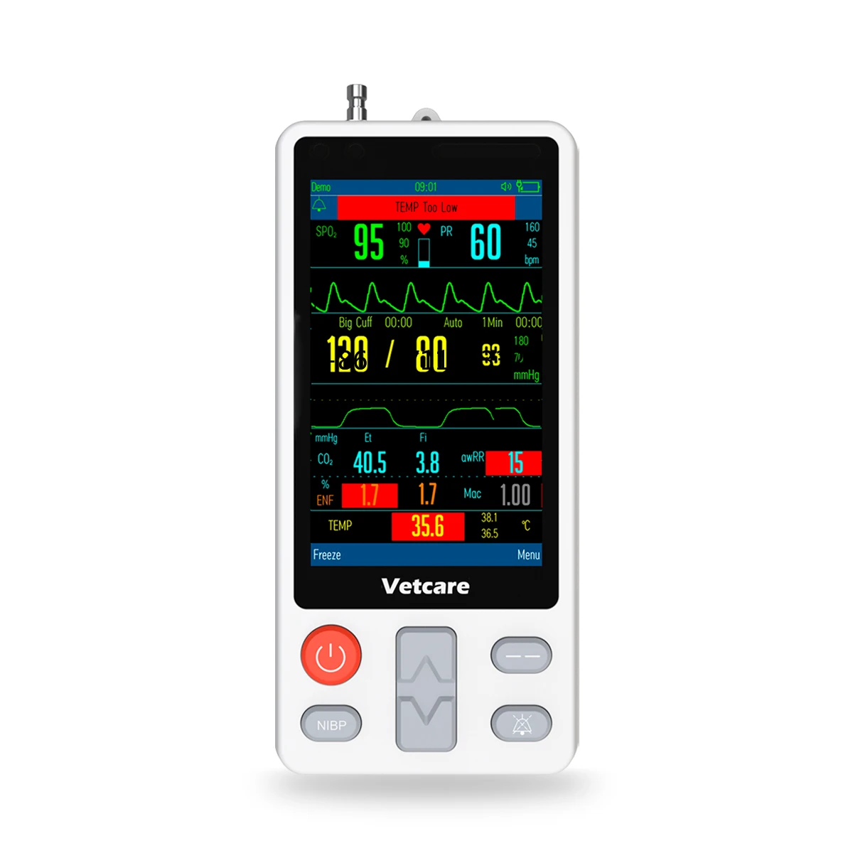 VETCARE HMVET 3.5 Inch Veterinary Capnograph Monitor Equipment for Animal Use High Quality Veterinary Monitoring Devices
VETCARE HMVET 3.5 Inch Veterinary Capnograph Monitor Equipment for Animal Use High Quality Veterinary Monitoring Devices