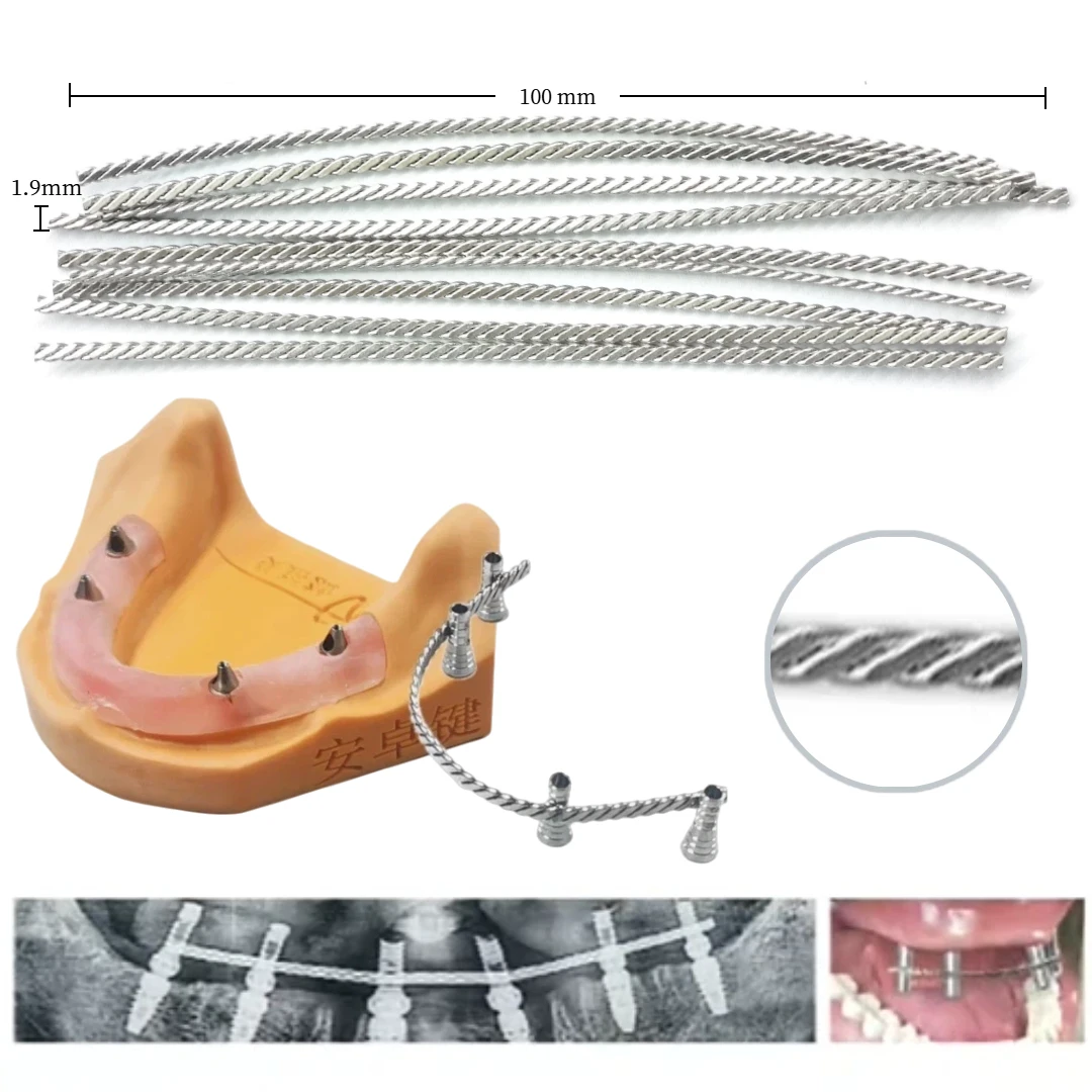Коннекторы для дентальных имплантатов, фиксаторы для ортопедических протезов, укрепляющие проволочные пружины, проволочные фиксаторы для полной дуги, для немедленной реставрации
Коннекторы для дентальных имплантатов, фиксаторы для ортопедических протезов, укрепляющие проволочные пружины, проволочные фиксаторы для полной дуги, для немедленной реставрации