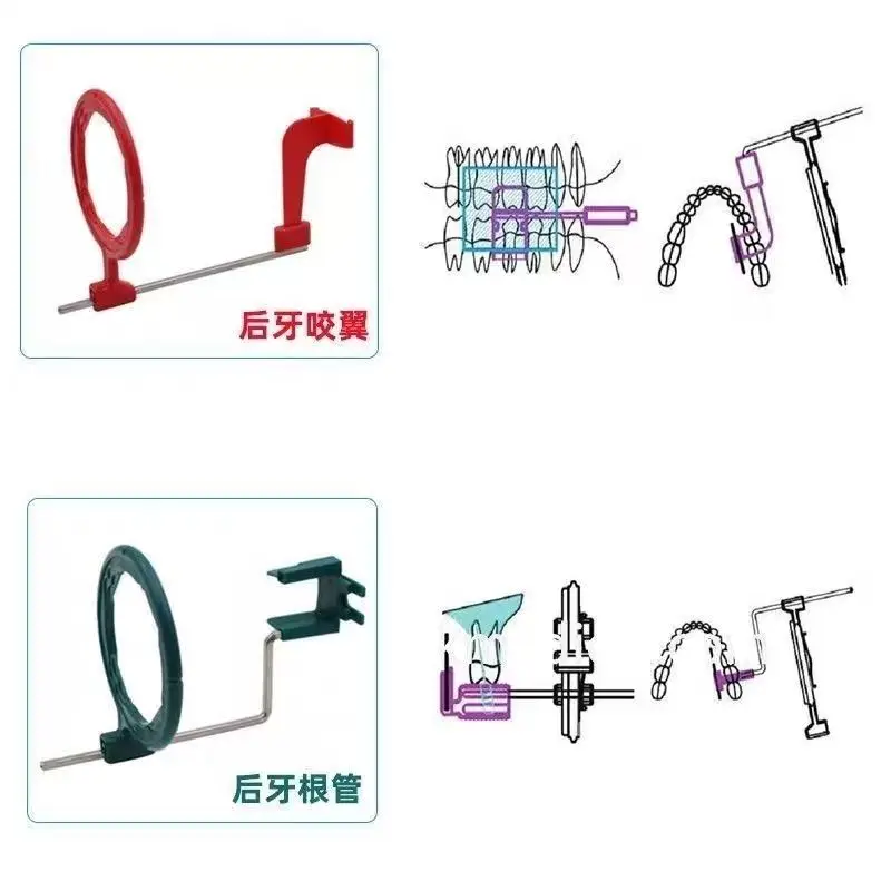 Стоматологический рентгеновский локатор, держатель пленки, параллельный набор, кронштейн, проекционный держатель стоматологической пленки
Стоматологический рентгеновский локатор, держатель пленки, параллельный набор, кронштейн, проекционный держатель стоматологической пленки