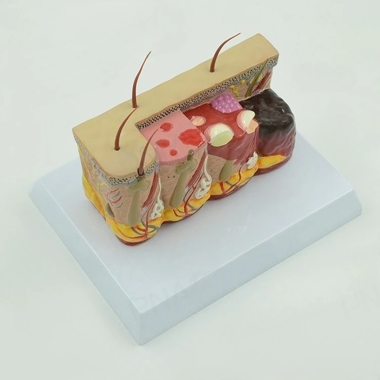 Human skin tissue hierarchy anatomical model teaching
Human skin tissue hierarchy anatomical model teaching