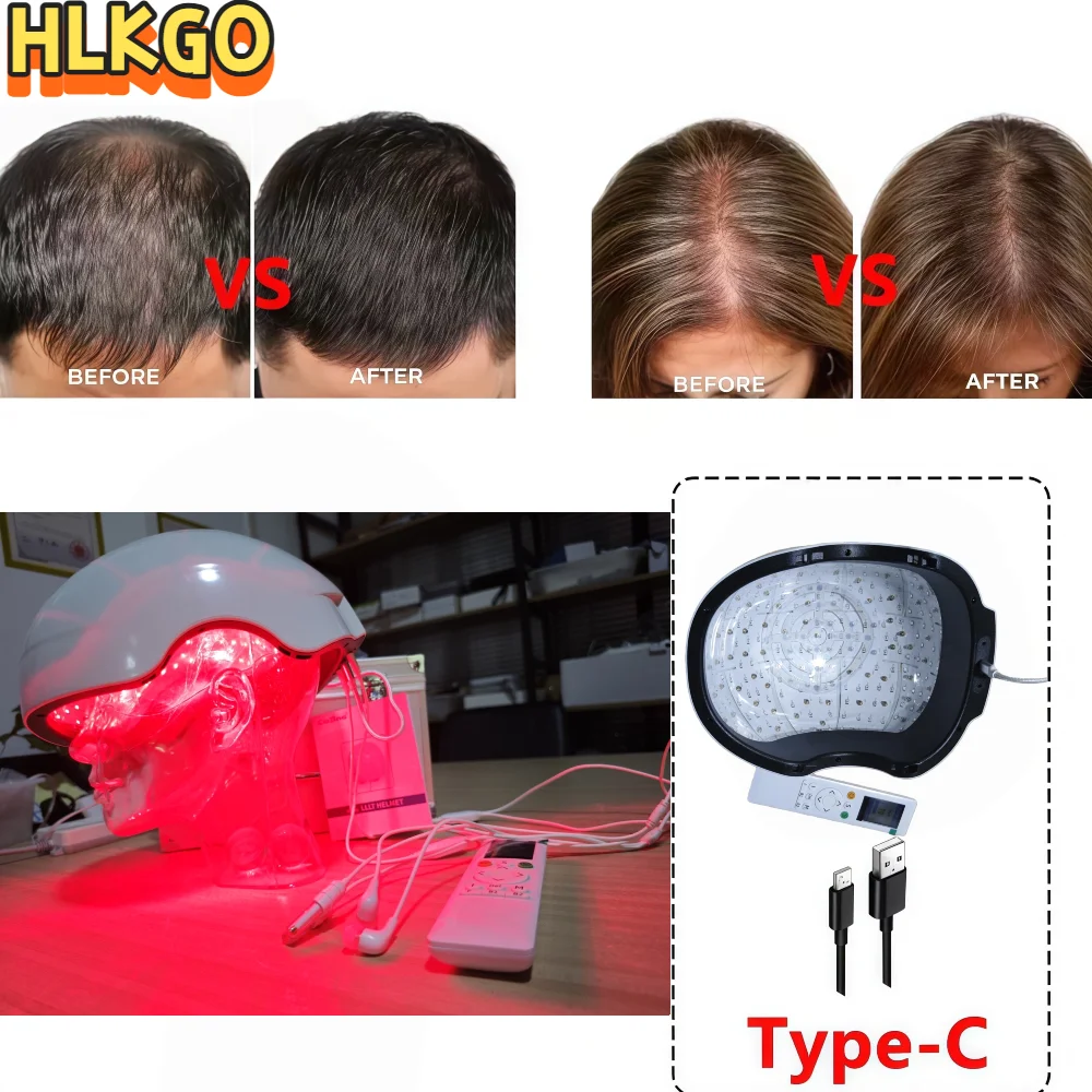 6750mW LED & Laser Hair Growth Cap, 210 LEDs & 90 Lasers 650nm 660nm, for Fast Regrowth Anti Hair Loss and Scalp Care Hat
6750mW LED & Laser Hair Growth Cap, 210 LEDs & 90 Lasers 650nm 660nm, for Fast Regrowth Anti Hair Loss and Scalp Care Hat