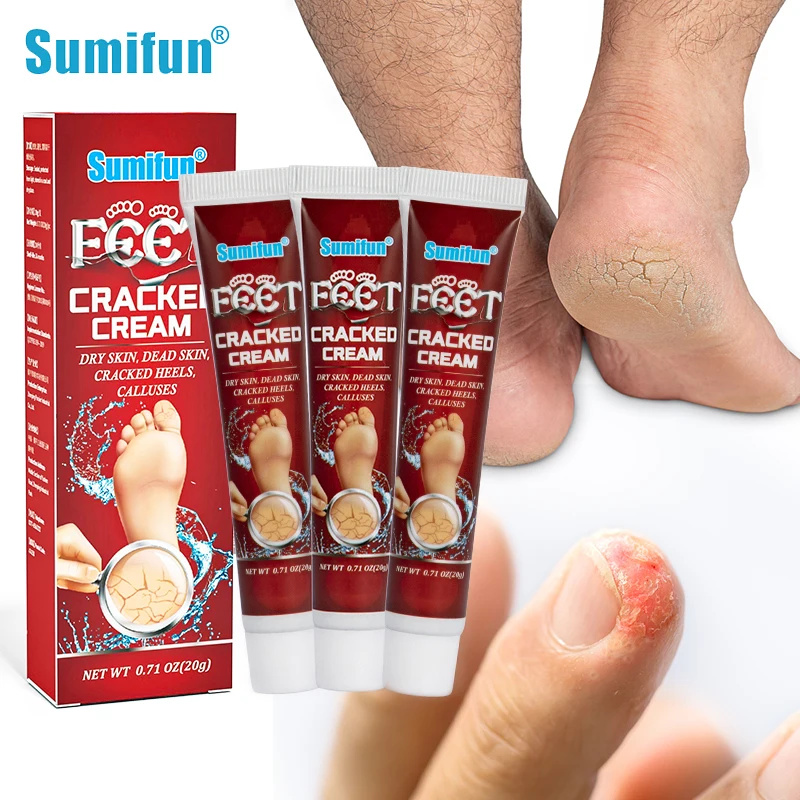 3/5Pcs Sumifun Anti Crack Foot Cream Heel Repair Feet Peeling Dead Skin Remover Dry Skin Moisturizer Hand Callus Care Ointment
3/5Pcs Sumifun Anti Crack Foot Cream Heel Repair Feet Peeling Dead Skin Remover Dry Skin Moisturizer Hand Callus Care Ointment