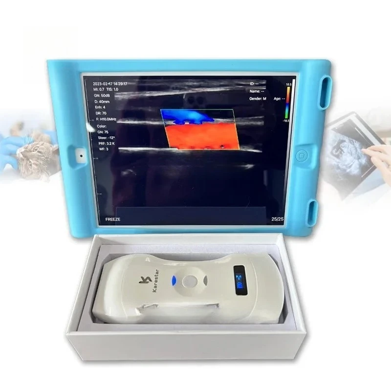 2025.4 Karestar 3 в 1, мобильный ветеринарный сканер для смартфона, беспроводная карманная машина для Android/IOS
2025.4 Karestar 3 в 1, мобильный ветеринарный сканер для смартфона, беспроводная карманная машина для Android/IOS