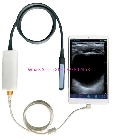 Bovine/cattle/ Farm Scanning IPX7 Waterproof Intelligent USB Ultrasound System Portable Veterinary Ultrasound Probe Wifi connect
Bovine/cattle/ Farm Scanning IPX7 Waterproof Intelligent USB Ultrasound System Portable Veterinary Ultrasound Probe Wifi connect