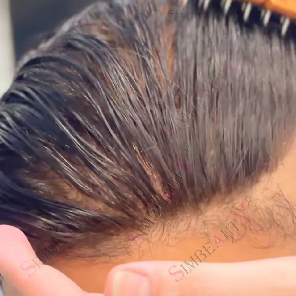 Супер легкий вес, 80% 0,02 мм, ультратонкая кожа, натуральная линия волос, мужской парик, невидимый HD поли, темно-коричневый, серый 440 # Человеческий шиньон
Супер легкий вес, 80% 0,02 мм, ультратонкая кожа, натуральная линия волос, мужской парик, невидимый HD поли, темно-коричневый, серый 440 # Человеческий шиньон