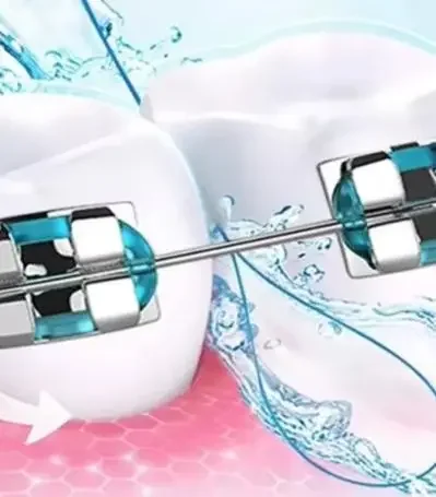 Dental Traction Line Oral Cleaning For Crown Brace Bridge Implant Hoop Threading Braces Steel Traction
Dental Traction Line Oral Cleaning For Crown Brace Bridge Implant Hoop Threading Braces Steel Traction