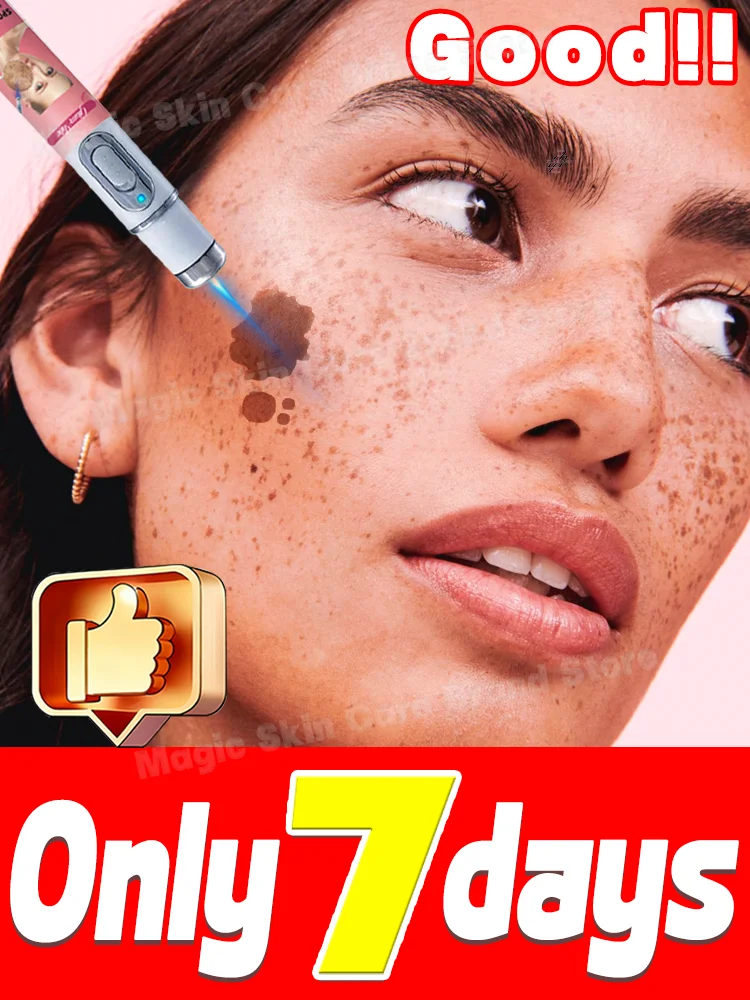 Устройство Blue Light Repair Device с помощью очищающего инструмента точно воздействует на несовершенства кожи, устраняя все проблемы с пигментацией и делая цвет лица гладким и безупречным.
Устройство Blue Light Repair Device с помощью очищающего инструмента точно воздействует на несовершенства кожи, устраняя все проблемы с пигментацией и делая цвет лица гладким и безупречным.