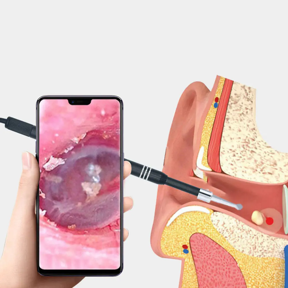 Камера для осмотра уха 55 мм, визуальный отоскоп высокой четкости с 6 светодиодами, безопасный инструмент для глубокой чистки для всех
Камера для осмотра уха 55 мм, визуальный отоскоп высокой четкости с 6 светодиодами, безопасный инструмент для глубокой чистки для всех