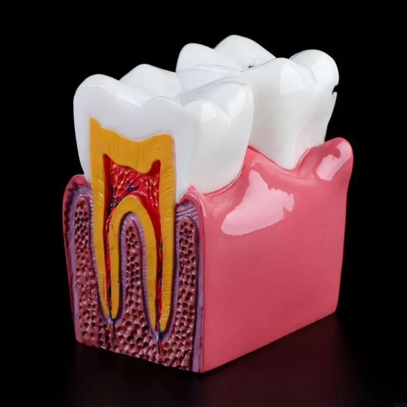 6 Caries Comparation Anatomy Teeth Model for Dental Anatomy Lab Tea Drop Shipping
6 Caries Comparation Anatomy Teeth Model for Dental Anatomy Lab Tea Drop Shipping