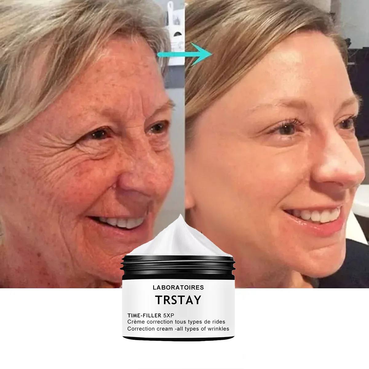 TRSTAY Увлажняющий крем, восстанавливающий морщины, уход за кожей, крем для лица, подходит для различных типов кожи, отбеливание, даже кожу
TRSTAY Увлажняющий крем, восстанавливающий морщины, уход за кожей, крем для лица, подходит для различных типов кожи, отбеливание, даже кожу