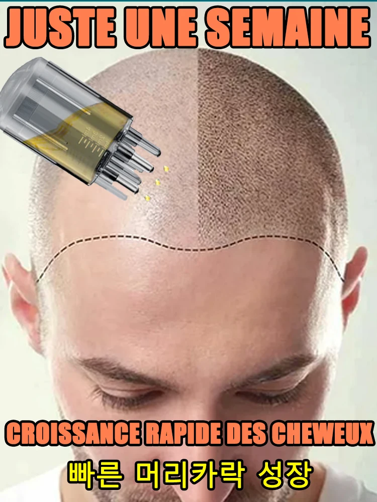 100% revive hair, strong penetration, activate hair roots, more hair, say goodbye to baldness, thick hair
100% revive hair, strong penetration, activate hair roots, more hair, say goodbye to baldness, thick hair