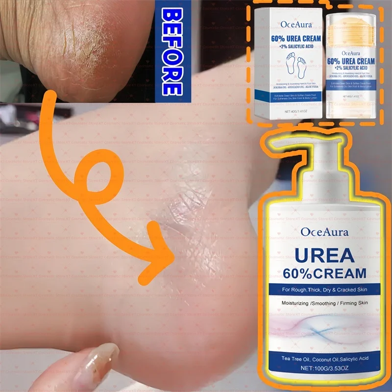 60% Urea Feet Cream Extreme Dry Cracked Rough Thick Dead Skin 2% Salicylic Acid Soften Exfoliate Moisturizer Smooth Nourish Hand
60% Urea Feet Cream Extreme Dry Cracked Rough Thick Dead Skin 2% Salicylic Acid Soften Exfoliate Moisturizer Smooth Nourish Hand