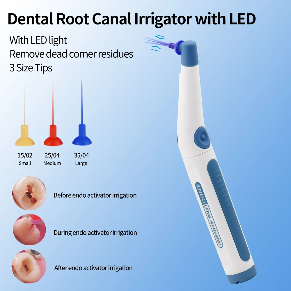 Dental Wireless Ultrasonic Activator LED Endo Ultra Activator Washing Tooth with 150 Tips Dentistry Tools
Dental Wireless Ultrasonic Activator LED Endo Ultra Activator Washing Tooth with 150 Tips Dentistry Tools