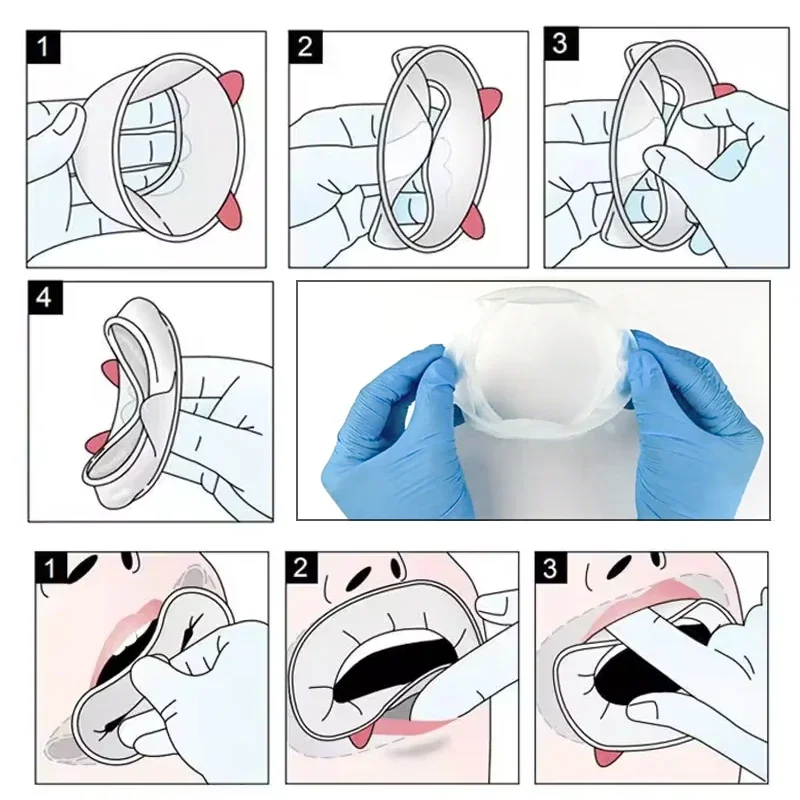 Dental Mouth Opener 3D Lip Cheek Retractor O Shape Rubber Expander for Oral Examination and Treatment Tools 
Dental Mouth Opener 3D Lip Cheek Retractor O Shape Rubber Expander for Oral Examination and Treatment Tools
