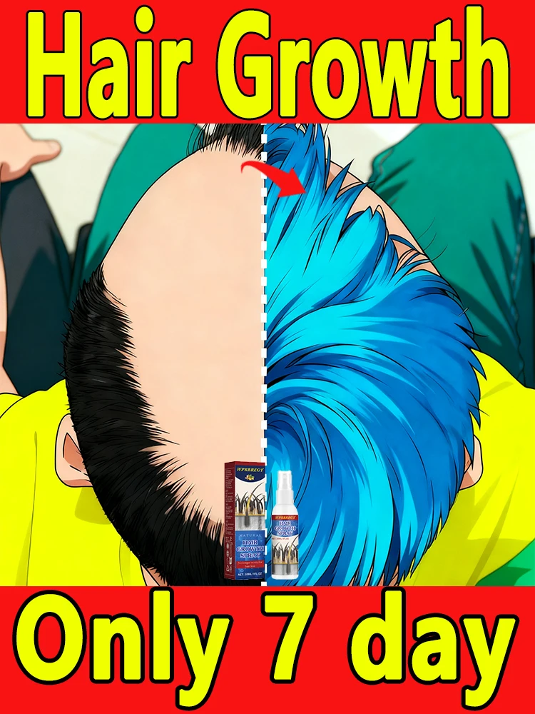 Fɪɴᴇ Hᴀɪʀ Tʜɪᴄᴋᴇɴɪɴɢ Mɪsᴛ - Sᴛʀᴇɴɢᴛʜᴇɴ Wᴇᴀᴋ Sᴛʀᴀɴᴅs, Sᴜᴘᴘᴏʀᴛ Gʀᴏᴡᴛʜ, Vᴏʟᴜᴍɪᴢɪɴɢ Fᴏʀᴍᴜʟᴀ
Fɪɴᴇ Hᴀɪʀ Tʜɪᴄᴋᴇɴɪɴɢ Mɪsᴛ - Sᴛʀᴇɴɢᴛʜᴇɴ Wᴇᴀᴋ Sᴛʀᴀɴᴅs, Sᴜᴘᴘᴏʀᴛ Gʀᴏᴡᴛʜ, Vᴏʟᴜᴍɪᴢɪɴɢ Fᴏʀᴍᴜʟᴀ