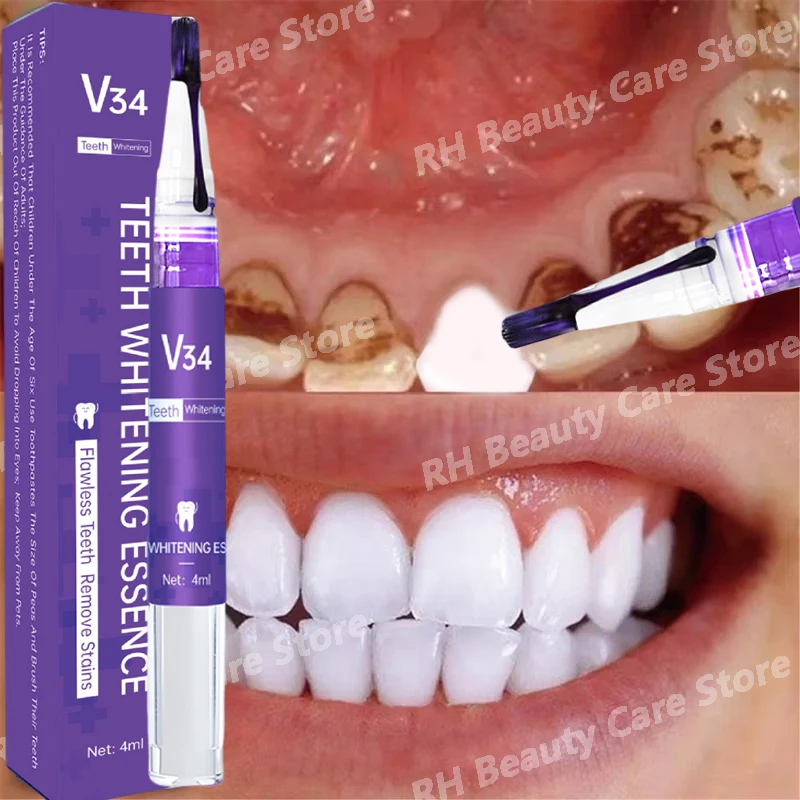 Purple Magical Teeth Whitening Pen Oral Cleaning Removing Dental Plaque Smoke Stains Coffee Stains Brightening Teeth Care
Purple Magical Teeth Whitening Pen Oral Cleaning Removing Dental Plaque Smoke Stains Coffee Stains Brightening Teeth Care