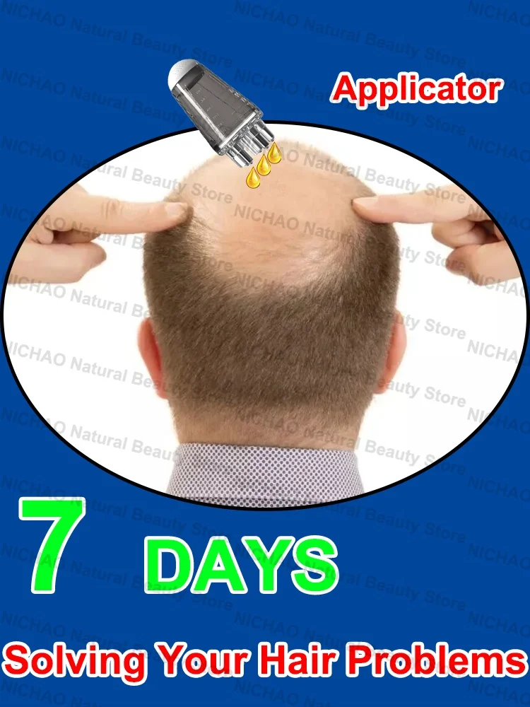 7 Days Fast Hair Growth Essential Loss Regrowth Treatment Strengthens Hair Nourishes Scalp Light Weight Non Greasy
7 Days Fast Hair Growth Essential Loss Regrowth Treatment Strengthens Hair Nourishes Scalp Light Weight Non Greasy