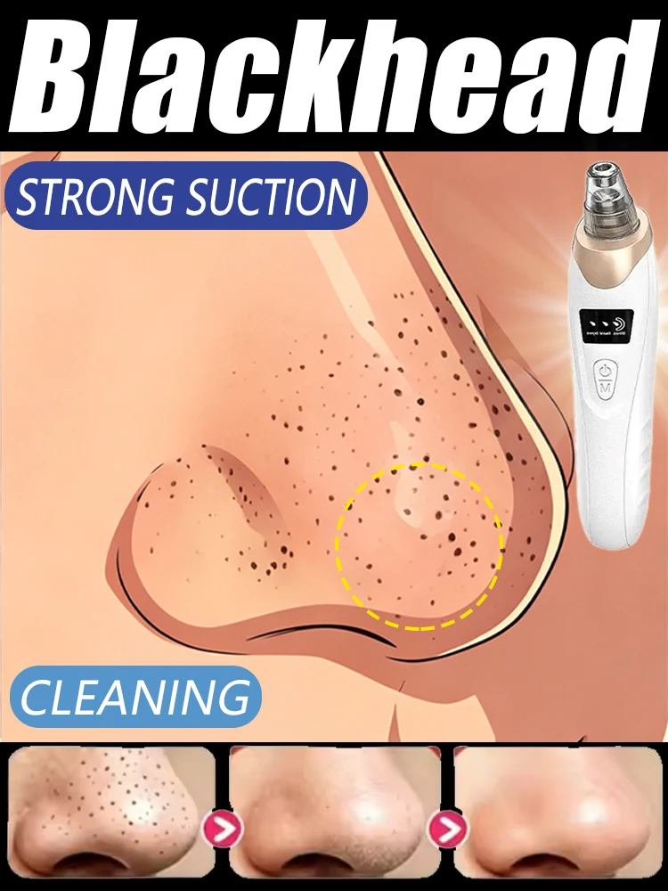 Home Use Skin Polishing & Pore Purifying Device, Facial Vacuum Kit for Deep Oil Control, Exfoliation & Invisible Dirt Extraction
Home Use Skin Polishing & Pore Purifying Device, Facial Vacuum Kit for Deep Oil Control, Exfoliation & Invisible Dirt Extraction