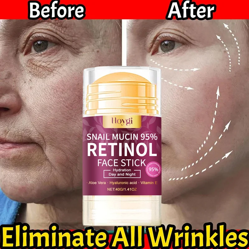 Instant Anti Wrinkle Stick Retinol Anti-Aging Lifting Firming Face Cream Fade Fine Lines Brighten Dull Skin Moisturize Skin Care
Instant Anti Wrinkle Stick Retinol Anti-Aging Lifting Firming Face Cream Fade Fine Lines Brighten Dull Skin Moisturize Skin Care