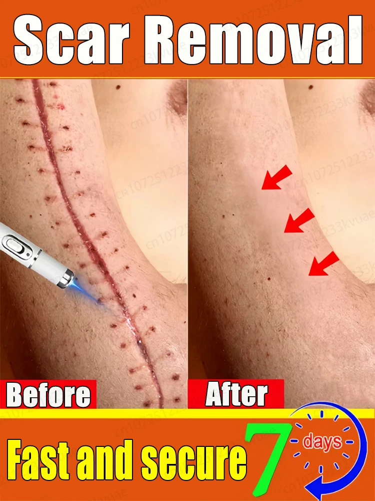 Eliminate all scars. Restore healthy skin quickly and safely 
Eliminate all scars. Restore healthy skin quickly and safely