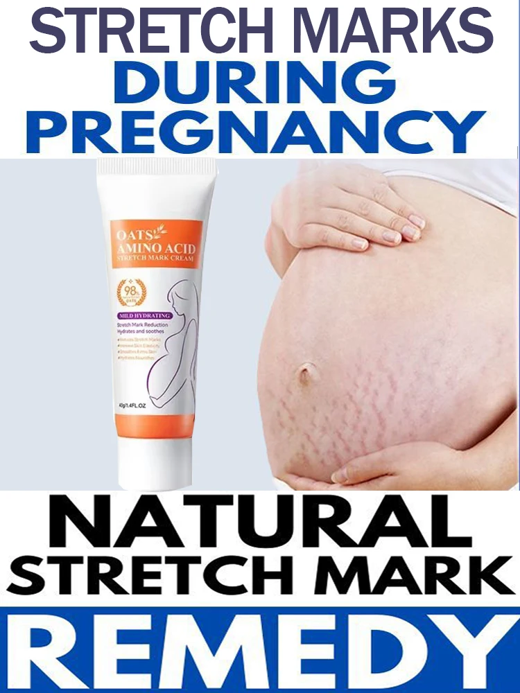 Remove Skin Cracks Repair Firming Care Stretch Marks Moisturize Cream Eliminate Body Belly Stretch Marks Removal Swelling Marks
Remove Skin Cracks Repair Firming Care Stretch Marks Moisturize Cream Eliminate Body Belly Stretch Marks Removal Swelling Marks