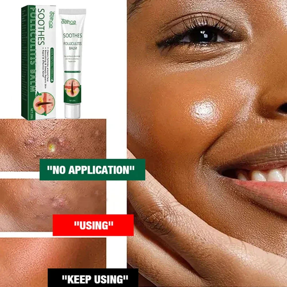 Natural Acne Remover Face Serum, Pimple Remover, Pore Minimizer, Oil Control Skin Care Solution
Natural Acne Remover Face Serum, Pimple Remover, Pore Minimizer, Oil Control Skin Care Solution