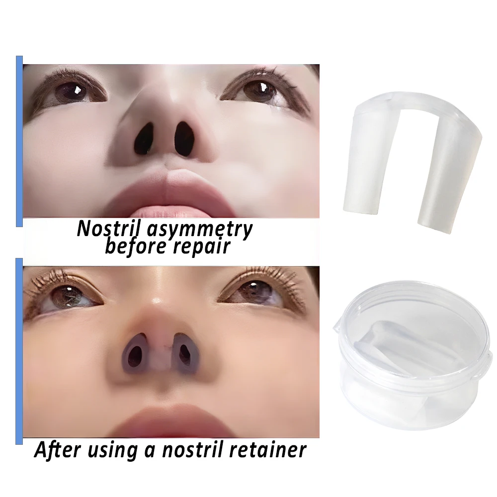 Фиксатор ноздрей Фиксатор ноздрей для восстановления ринопластики Фиксатор носа Хирургический формирователь носа Поддержка устройства Формирование восстановления
Фиксатор ноздрей Фиксатор ноздрей для восстановления ринопластики Фиксатор носа Хирургический формирователь носа Поддержка устройства Формирование восстановления