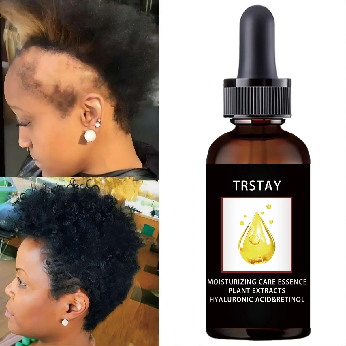 Head Hair Care Growth Oil for Men Women Ginseng Hair Oil Improves Frizz and Nourishes Hair
Head Hair Care Growth Oil for Men Women Ginseng Hair Oil Improves Frizz and Nourishes Hair