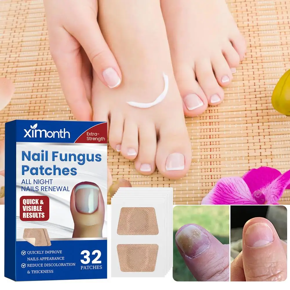 Nail Repair Patches Toenail Fungus Patch Sticky Toenail Nail Correction Ingrown Patch 32 Care Treatment Nail Paronychia Sti R9D5
Nail Repair Patches Toenail Fungus Patch Sticky Toenail Nail Correction Ingrown Patch 32 Care Treatment Nail Paronychia Sti R9D5