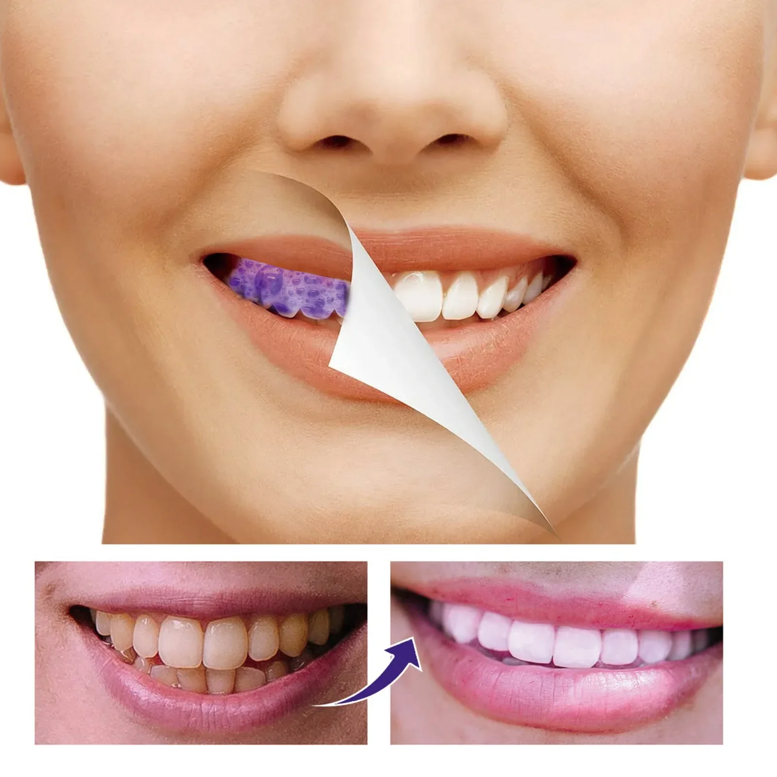 Sdottor New 5/1/pcs Teeth Whitening Mousse Deep Cleaning Cigarette Stains Repair Bright Neutralizes Yellow Tones Dental Plaque F
Sdottor New 5/1/pcs Teeth Whitening Mousse Deep Cleaning Cigarette Stains Repair Bright Neutralizes Yellow Tones Dental Plaque F