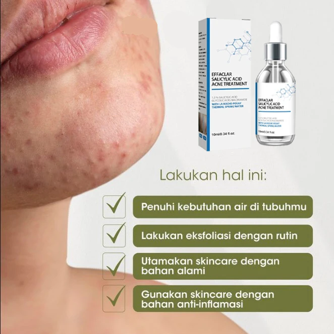 Anti acne facial essence, acne removing and smoothing skin, collagen protein, hyaluronic acid essence oil, skin care cosmetics
Anti acne facial essence, acne removing and smoothing skin, collagen protein, hyaluronic acid essence oil, skin care cosmetics