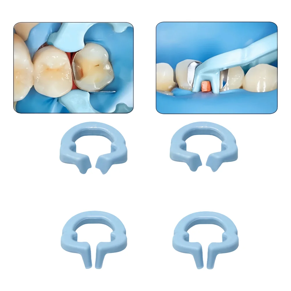 4 шт. автоклавируемые зажимные кольца из стоматологической смолы-резиновые зажимы для барьеров плотины на 134 ° C Процедуры стерилизации
4 шт. автоклавируемые зажимные кольца из стоматологической смолы-резиновые зажимы для барьеров плотины на 134 ° C Процедуры стерилизации