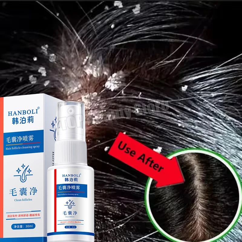 Hair Scalp Treatment Spray Remove Dandruff Itching Oil Control Anti Loss Scalp Cleaning Repair Serum Beauty Hair Care Products
Hair Scalp Treatment Spray Remove Dandruff Itching Oil Control Anti Loss Scalp Cleaning Repair Serum Beauty Hair Care Products