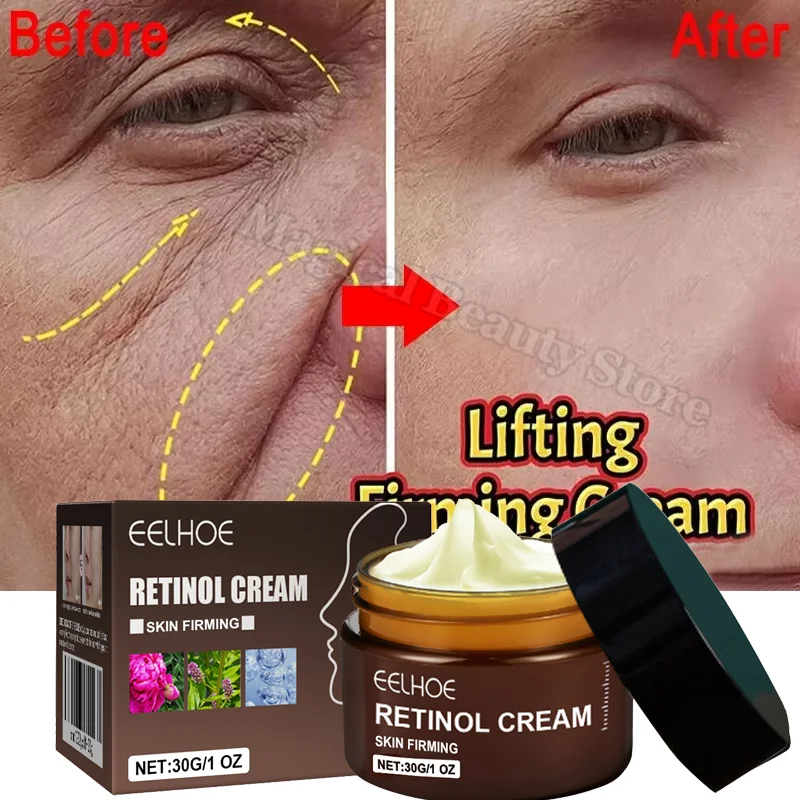 Retinol Face Cream Wrinkle Removal Firming Lifting Anti Aging Fade Fine Lines Moisturizing Whitening Skin Care Korean Cosmetics
Retinol Face Cream Wrinkle Removal Firming Lifting Anti Aging Fade Fine Lines Moisturizing Whitening Skin Care Korean Cosmetics