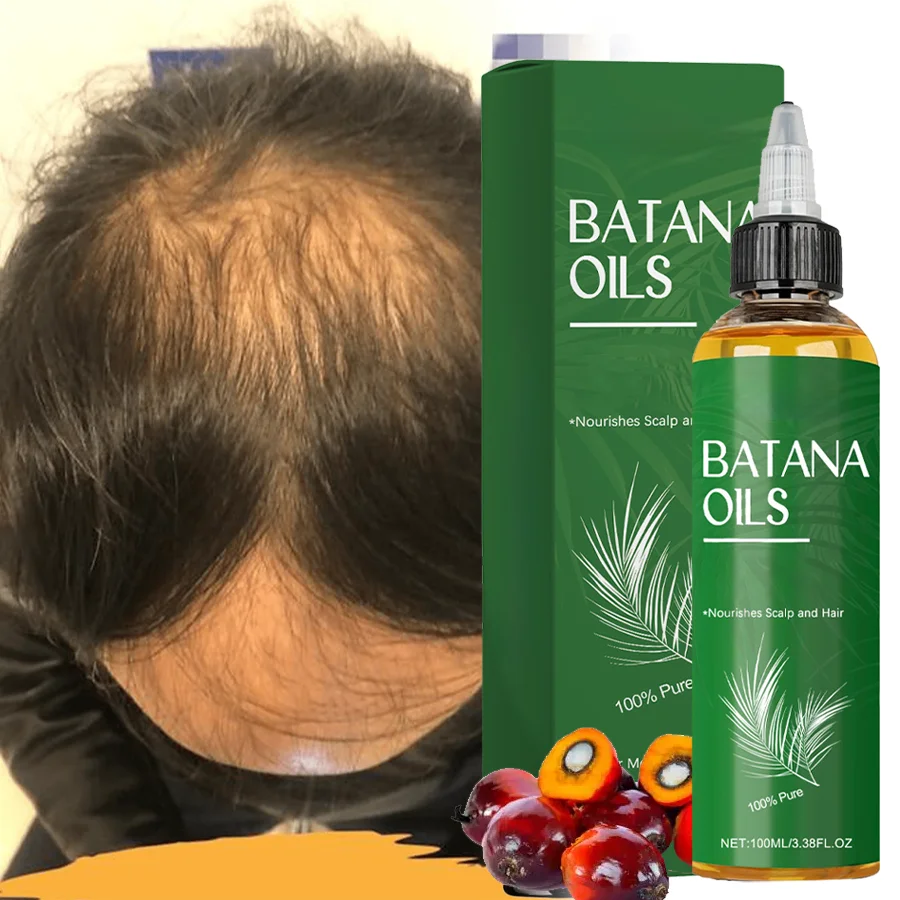 1 шт., эфирное масло для роста волос Батана, плотное укрепление волос, предотвращение выпадения, улучшение сухости волос, увлажняющее, блестящие волосы
1 шт., эфирное масло для роста волос Батана, плотное укрепление волос, предотвращение выпадения, улучшение сухости волос, увлажняющее, блестящие волосы