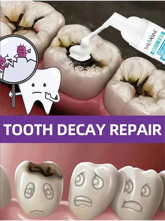 Карниз Ремонт Ремонт Восстановление кариеса Анти-защита кариеса
Карниз Ремонт Ремонт Восстановление кариеса Анти-защита кариеса