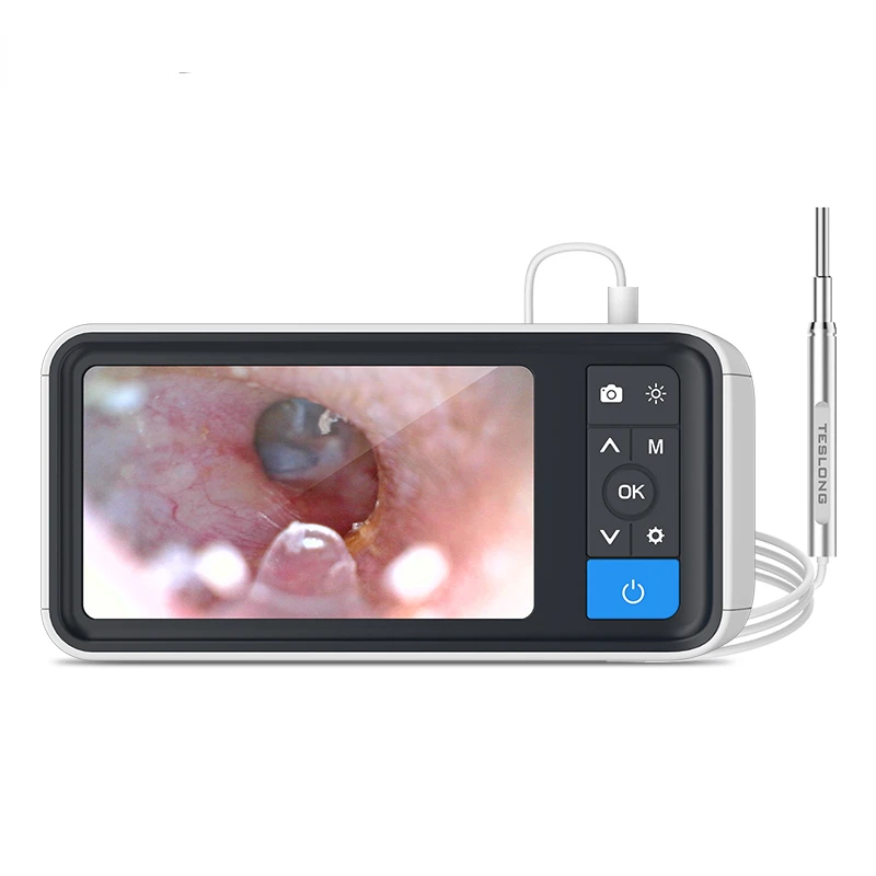 MS450 4.5inch smart ear cleaner otoscope scopearound mini ear scope endoscope ear cleaning
MS450 4.5inch smart ear cleaner otoscope scopearound mini ear scope endoscope ear cleaning