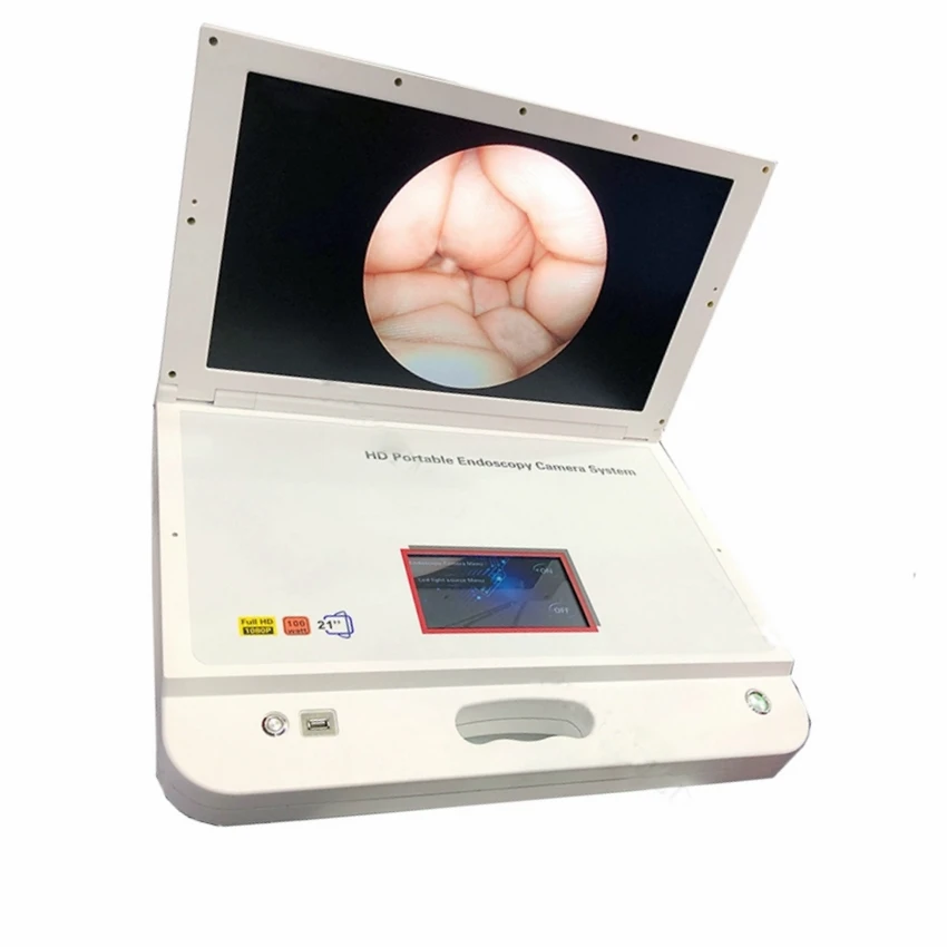 21'' ent portable aio endoscope camera endoscope endoscope light source
21'' ent portable aio endoscope camera endoscope endoscope light source