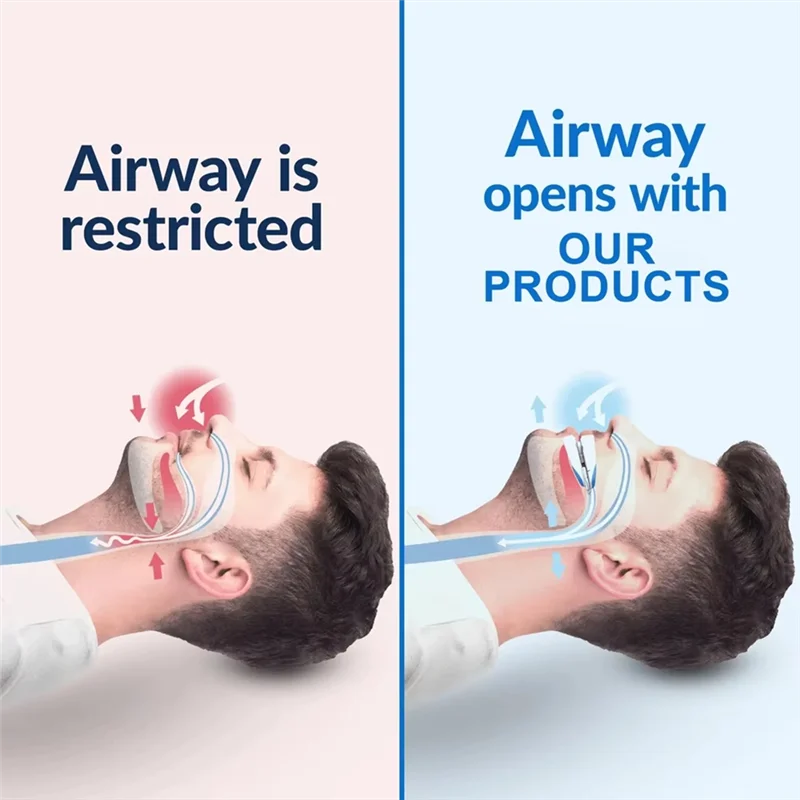 【Flash-Deal!】Adjustable Anti Snoring Mouth Guard Braces Sleeping Anti-Snoring Devices Bruxisms Snoring Stopper Improve Sleep Sno
【Flash-Deal!】Adjustable Anti Snoring Mouth Guard Braces Sleeping Anti-Snoring Devices Bruxisms Snoring Stopper Improve Sleep Sno