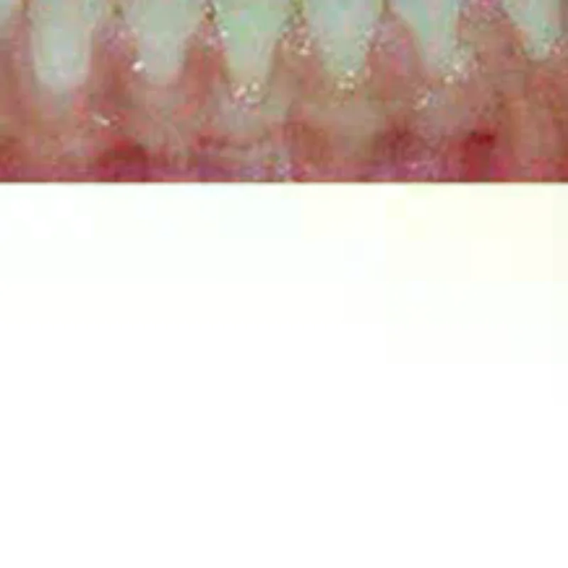 5/10g Temporary Tooth Repair Beads Missing Broken Teeth Dental Tooth Filling Material Food Grade False Teeth Solid Glue Denture
5/10g Temporary Tooth Repair Beads Missing Broken Teeth Dental Tooth Filling Material Food Grade False Teeth Solid Glue Denture