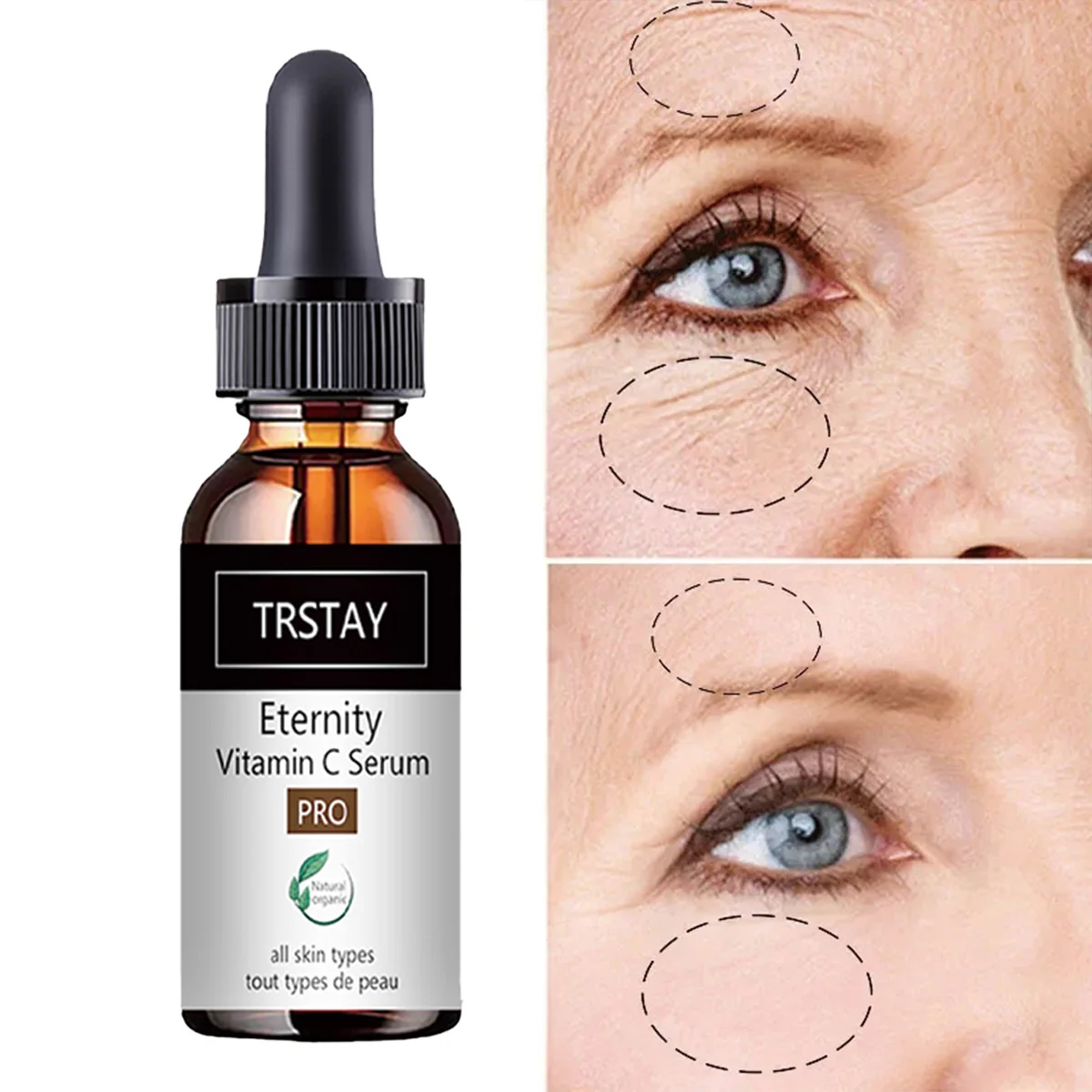 TRSTAY Eternal Vitamin C Essence Натуральный органический уход за кожей для всех типов кожи Крем для тела для мам и детей, беременных и беременных
TRSTAY Eternal Vitamin C Essence Натуральный органический уход за кожей для всех типов кожи Крем для тела для мам и детей, беременных и беременных