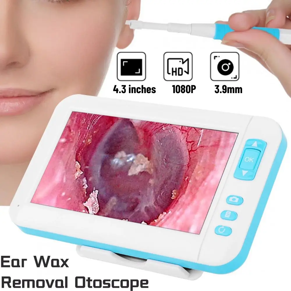 3.9MM Digital Otoscope Ear Cleaner Endoscope Camera 4.3Inch Screen Ear Wax Earpick Cleaner Tool with LED Lights Home Use
3.9MM Digital Otoscope Ear Cleaner Endoscope Camera 4.3Inch Screen Ear Wax Earpick Cleaner Tool with LED Lights Home Use