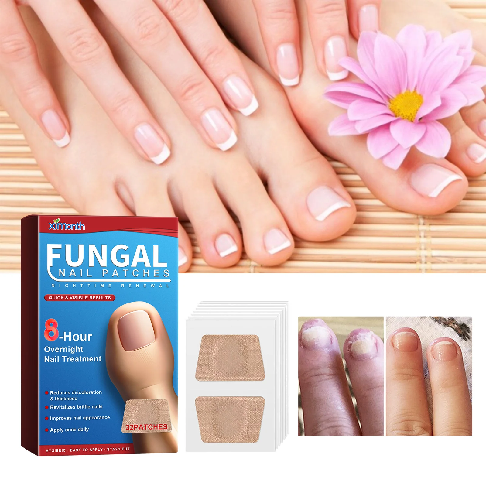 Ximonth Fungal Nail Repair Patches Nighttime Renewal Mild Nourishing Fast Acting For Damaged Discolored Nails Anti Infection
Ximonth Fungal Nail Repair Patches Nighttime Renewal Mild Nourishing Fast Acting For Damaged Discolored Nails Anti Infection