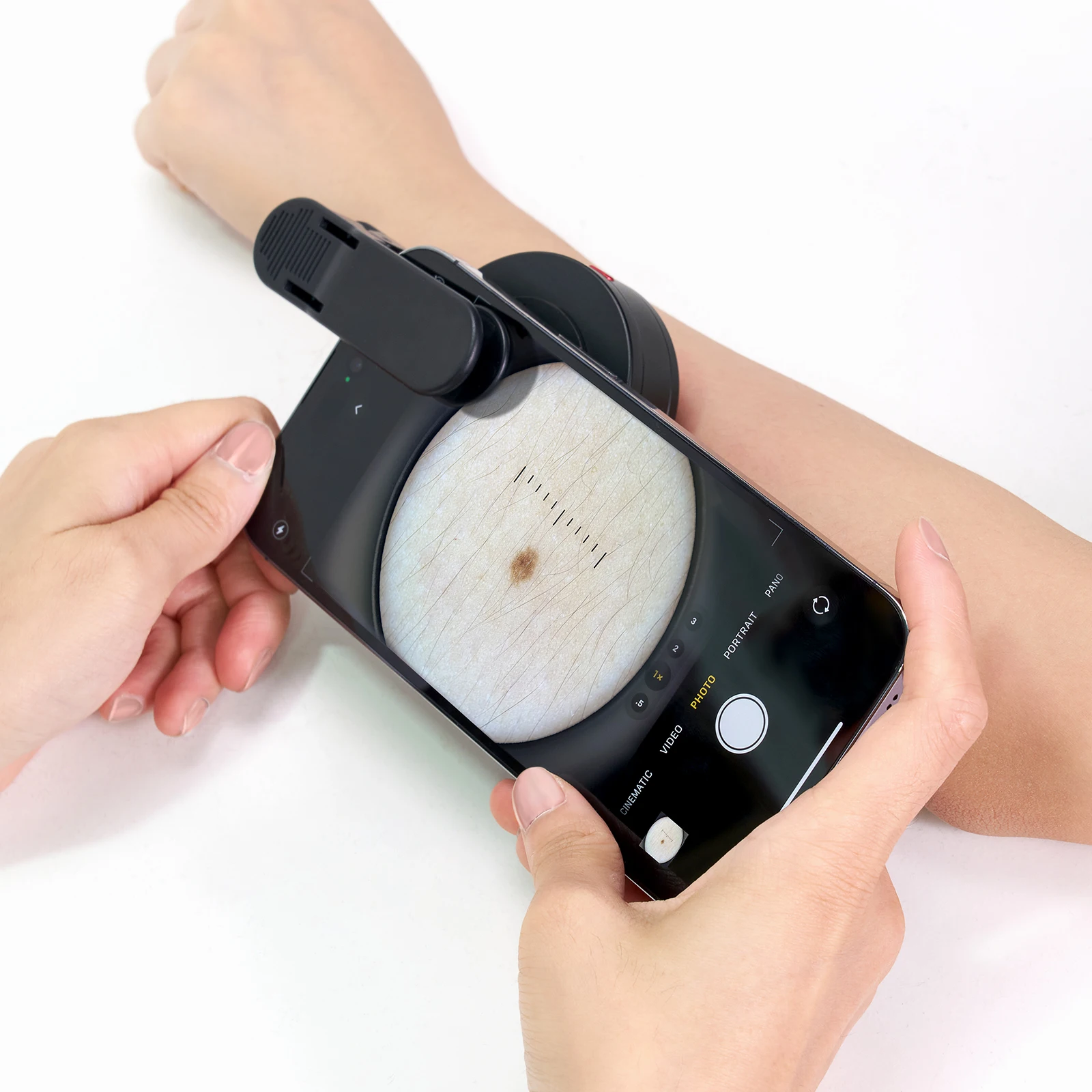 IBOOLO Manufacture OEM and ODM Mobile Handscope DE500 Clinical Dermatoscope for All PhoneSkin Analysis
IBOOLO Manufacture OEM and ODM Mobile Handscope DE500 Clinical Dermatoscope for All PhoneSkin Analysis