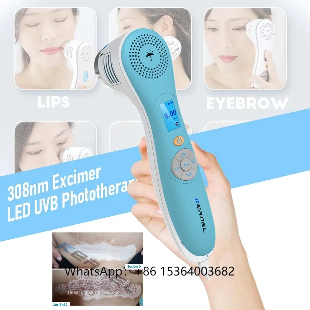 Kernel New Product KN-4003B4 LED 308nm Narrow Band UVB Light Therapy Excimer Laser Vitiligo Trageted UV Phototherapy Treatment
Kernel New Product KN-4003B4 LED 308nm Narrow Band UVB Light Therapy Excimer Laser Vitiligo Trageted UV Phototherapy Treatment