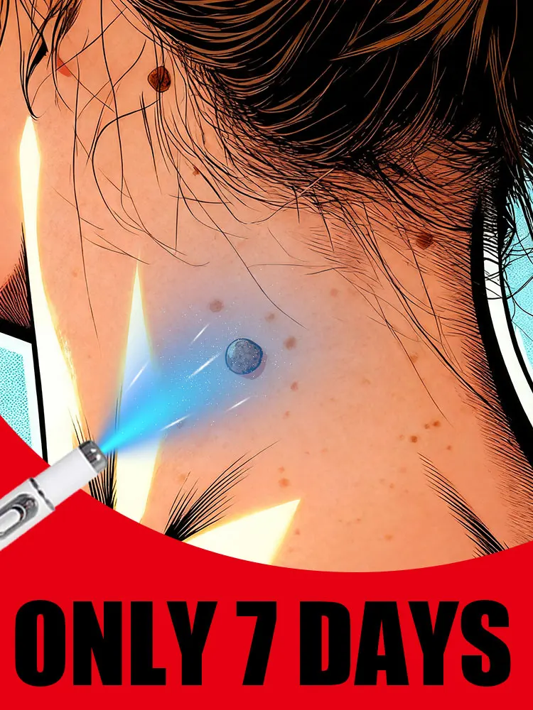 Outil Wart Blue Light, а также изысканные уборы sur les
Outil Wart Blue Light, а также изысканные уборы sur les